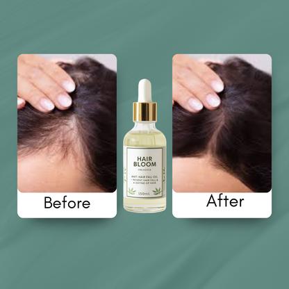 Hair Bloom – 100% Organic Anti-Hair Fall & Hair Grow Oil
