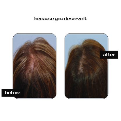 Hair Bloom – 100% Organic Anti-Hair Fall & Hair Grow Oil